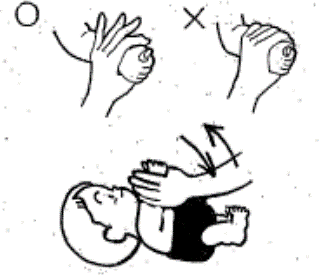 腕の体操の説明を示す図